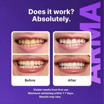 Purple Instant Teeth Whitening Strips